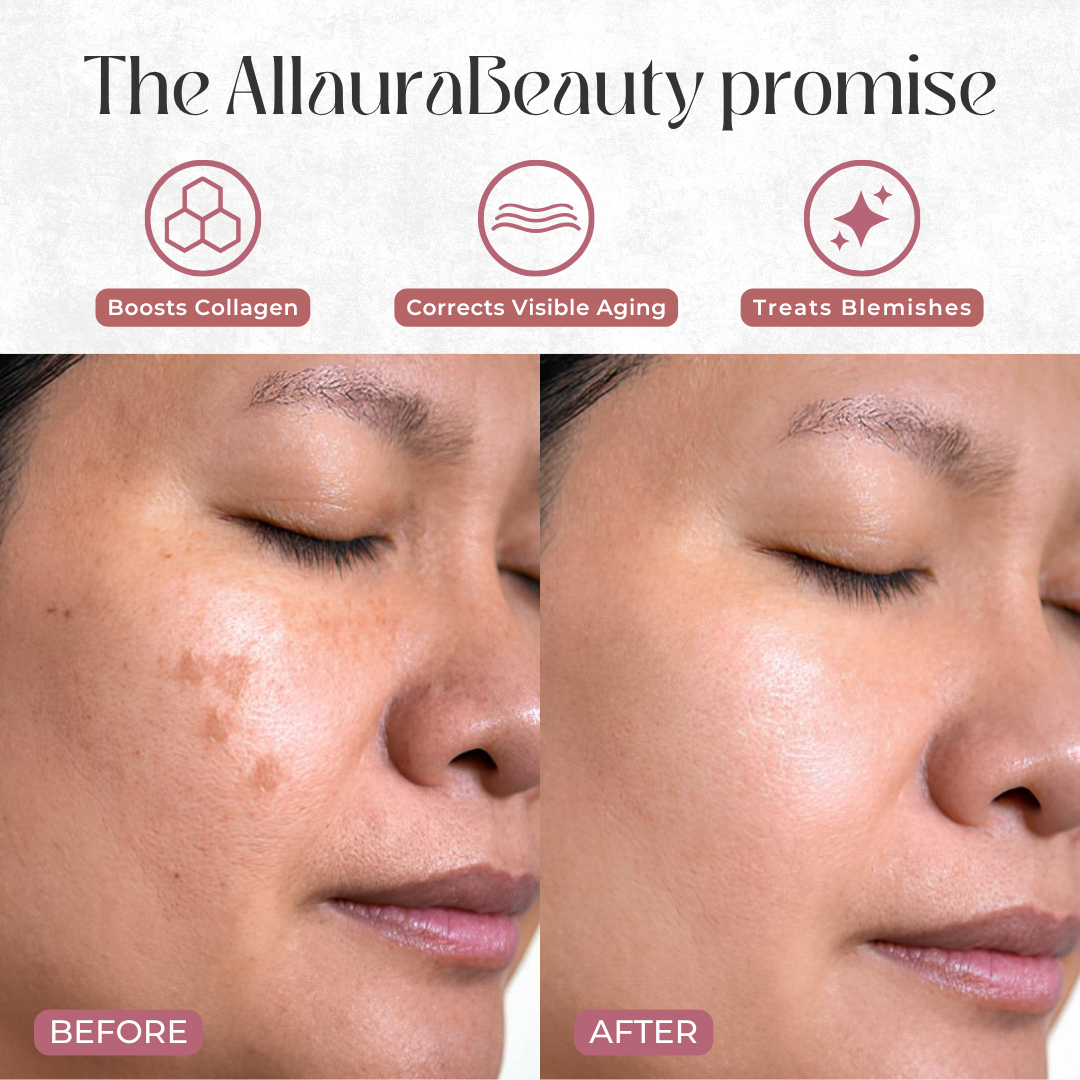 Toner Radiance Pads by Allaura Beauty