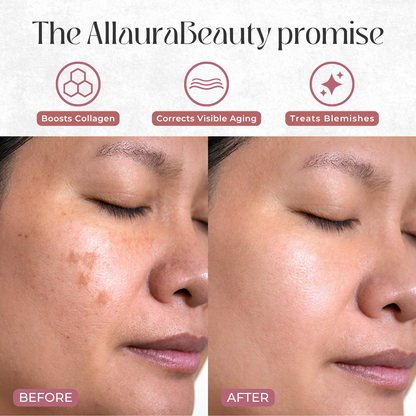 Toner Radiance Pads by Allaura Beauty